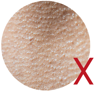 Non-comedogenic non-acnegenic